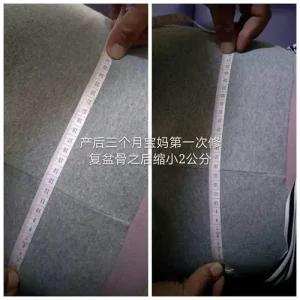產後三個月寶媽進行徒手骨盆修復與假胯寬矯正前卷尺量測對比