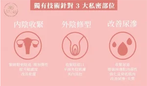 產後私密處收陰與緊緻修復三大部位圖解