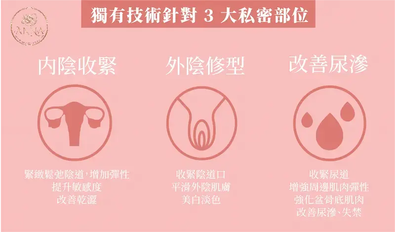 產後私密處收陰與緊緻修復三大部位圖解